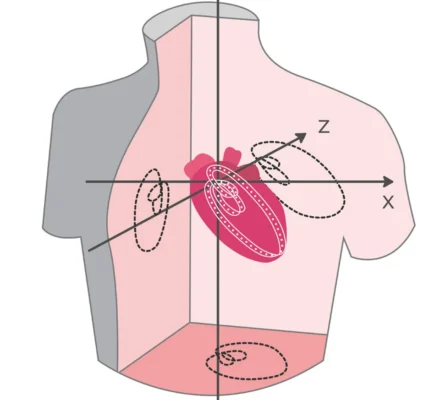 Vector ECG Vector ECG