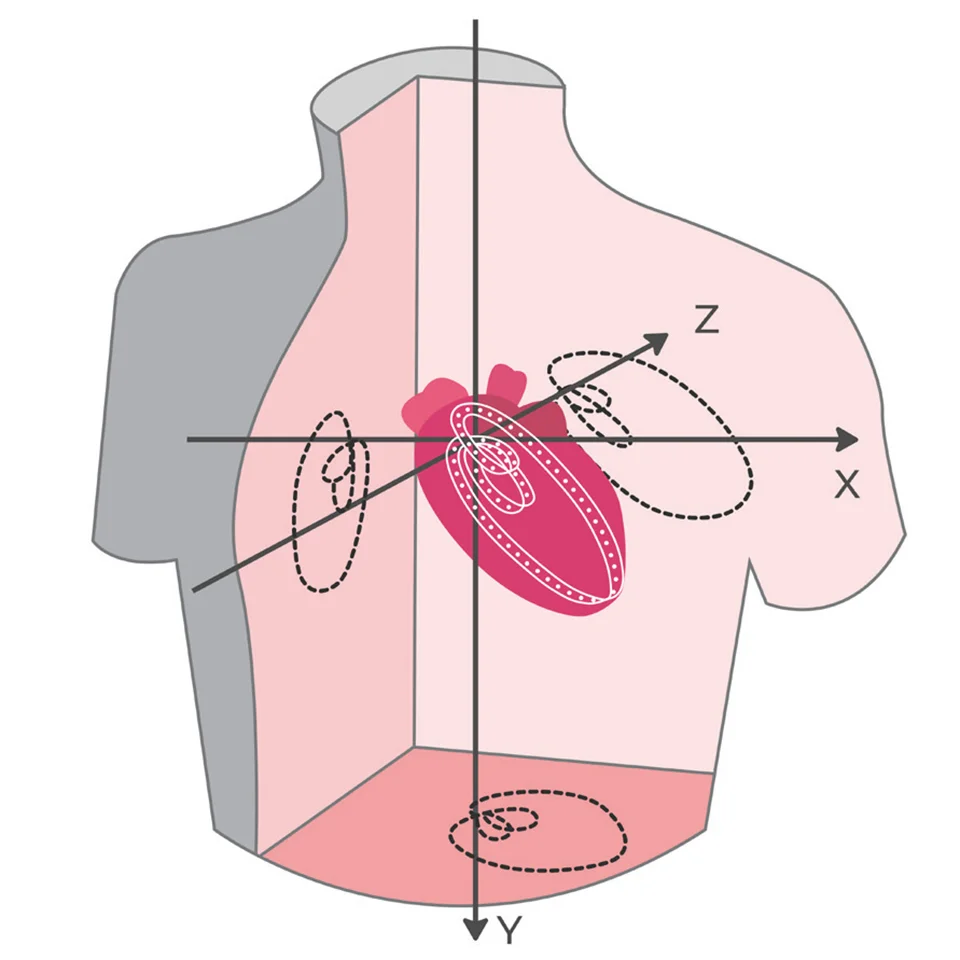 Vector ECG Vector ECG